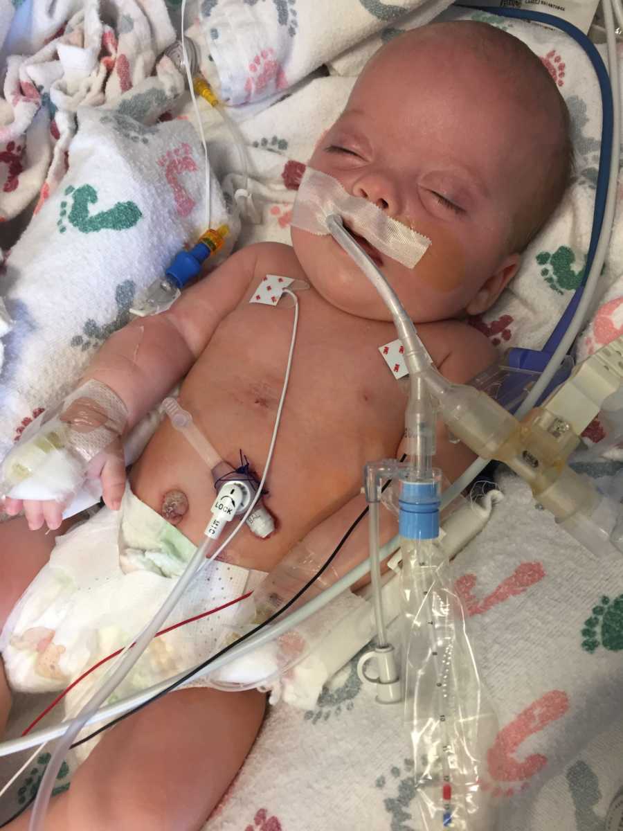 Baby lays on back in NICU who has been put in care of her 21 year old relative