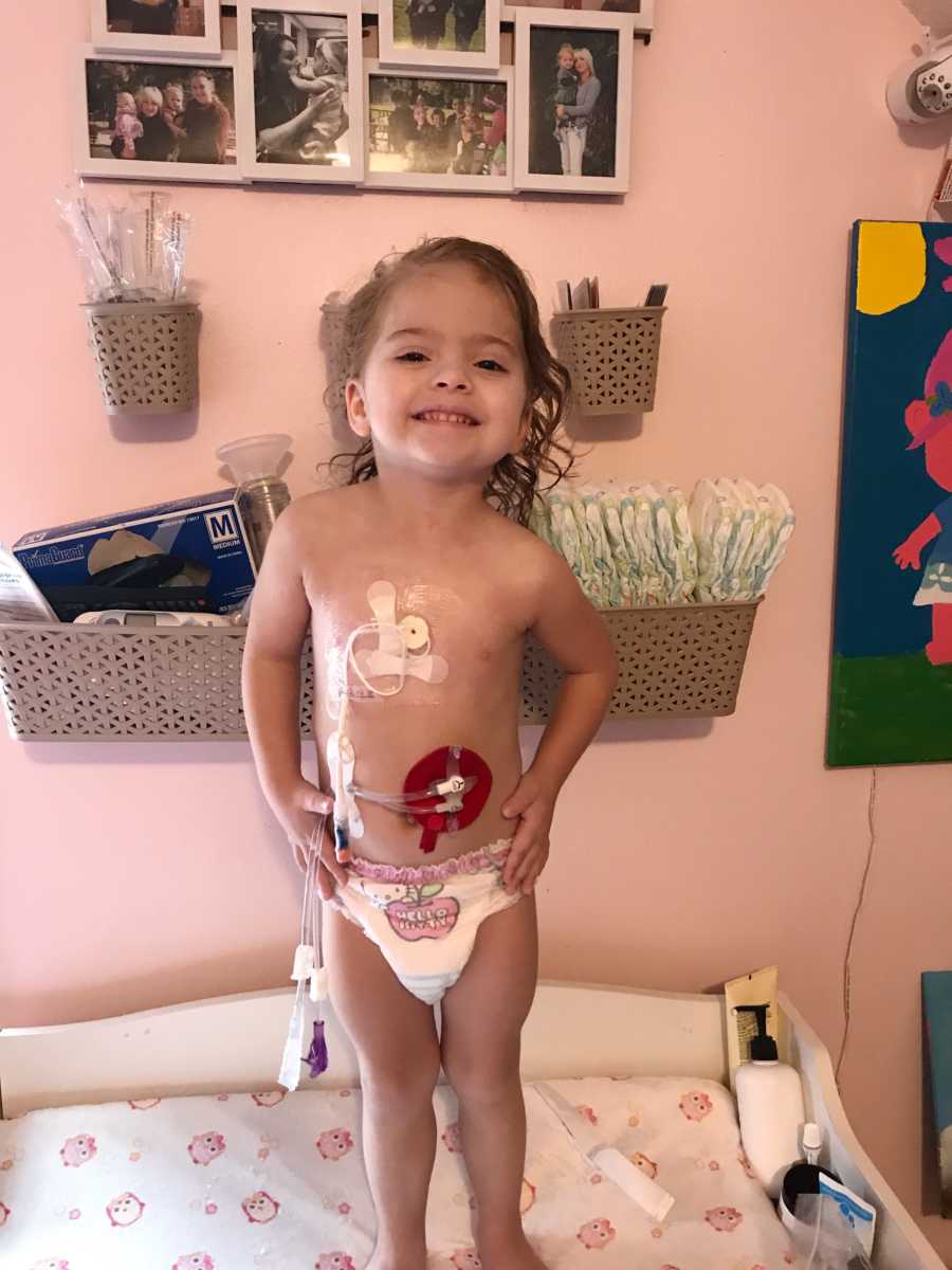 Little girl who lives in chronic pain stands in diaper on changing station of home with tubes attached to her chest