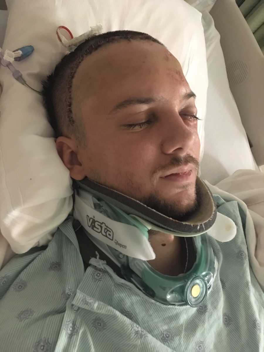 Msn who was in car crash lays in ICU with neck brace and staples on his head