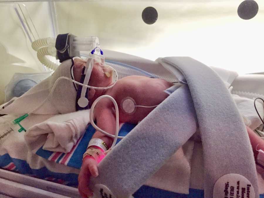 Preemie laying in NICU hooked up to monitors