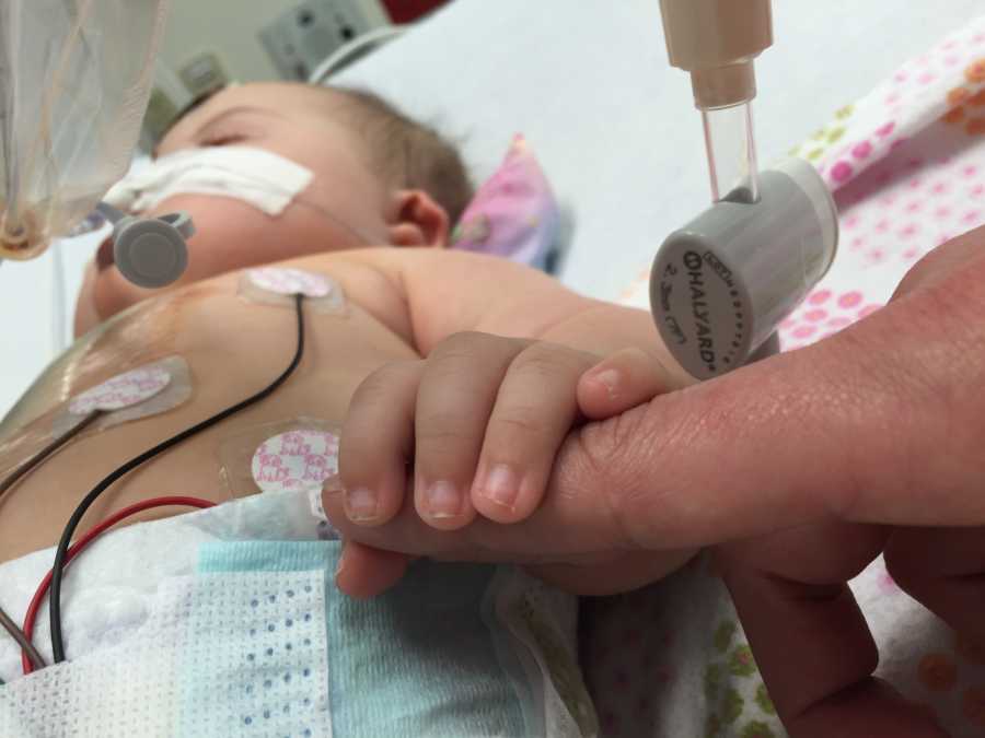 Baby lays in hospital holding parent's finger after having open heart surgery