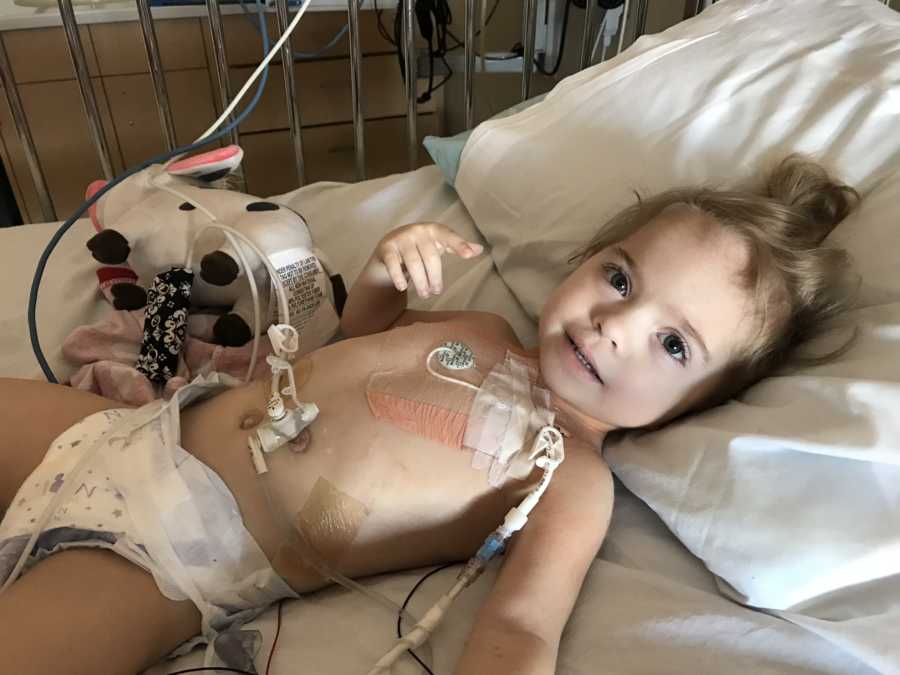 Little girl with several diseases lays in hospital bed with only a diaper on connected to monitors