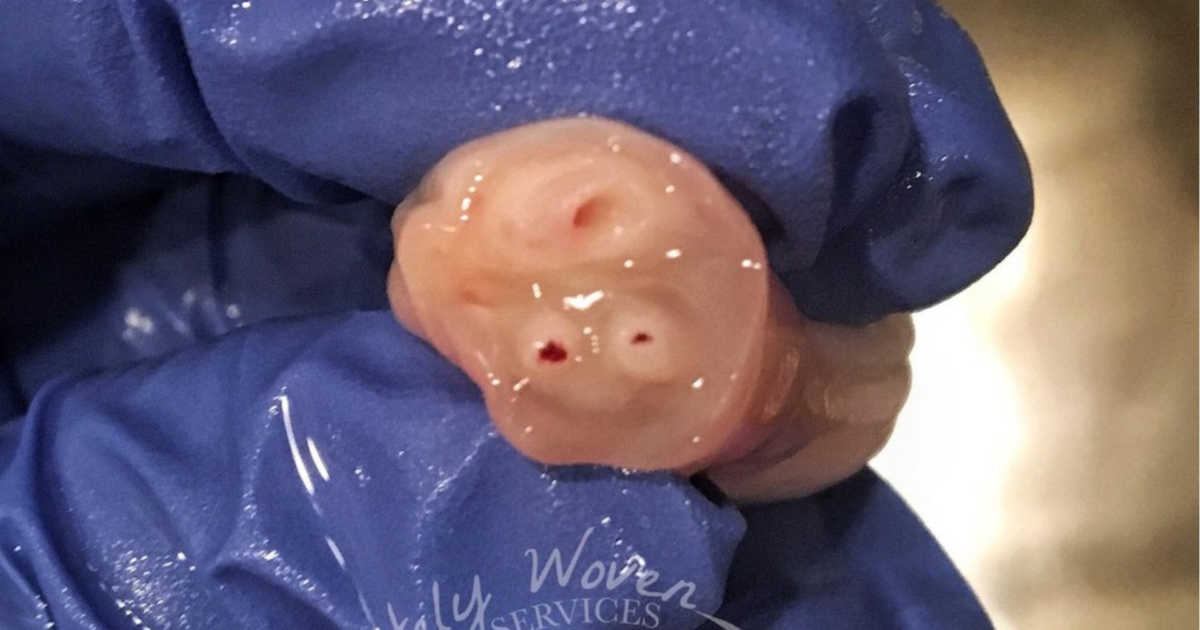 ‘I love inspecting the vessels in umbilical cords. My awe never ceases