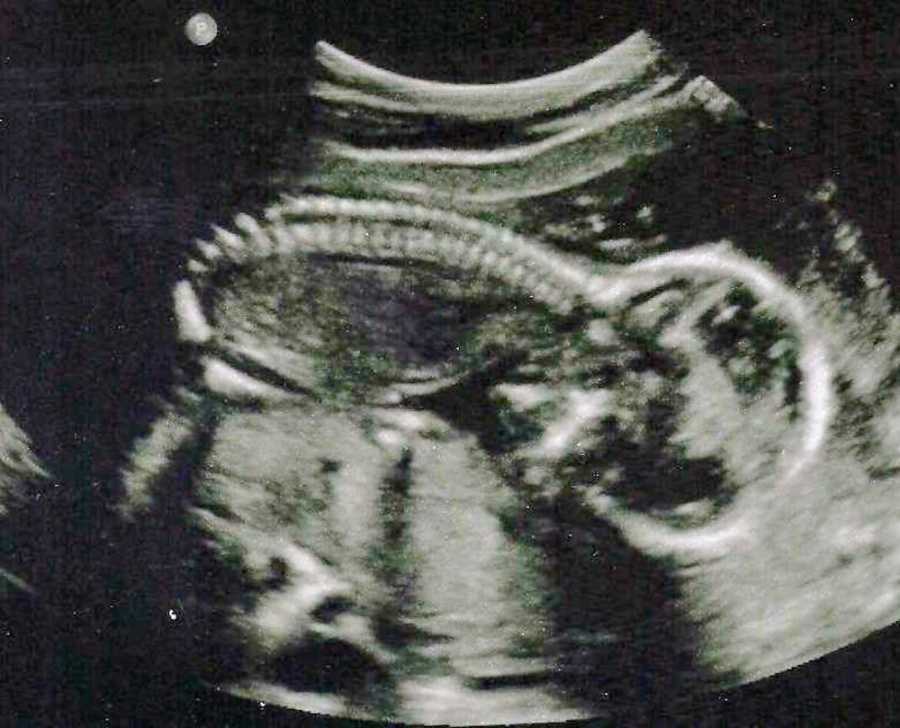 Ultrasound of baby who didn't live long