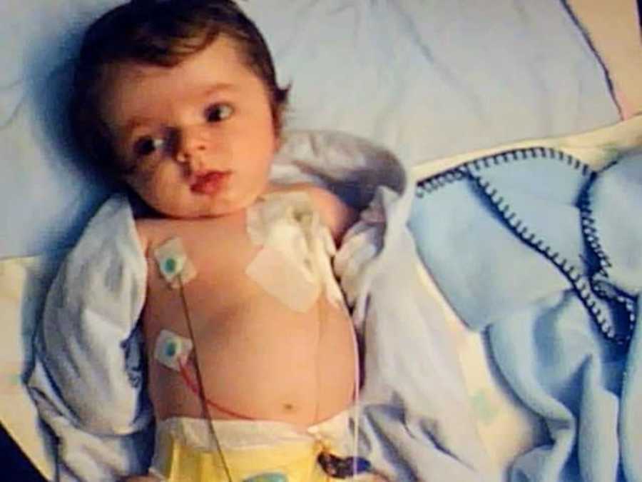 Baby who has had about 80 bone fractures since he has been born lays in PICU attached to monitors