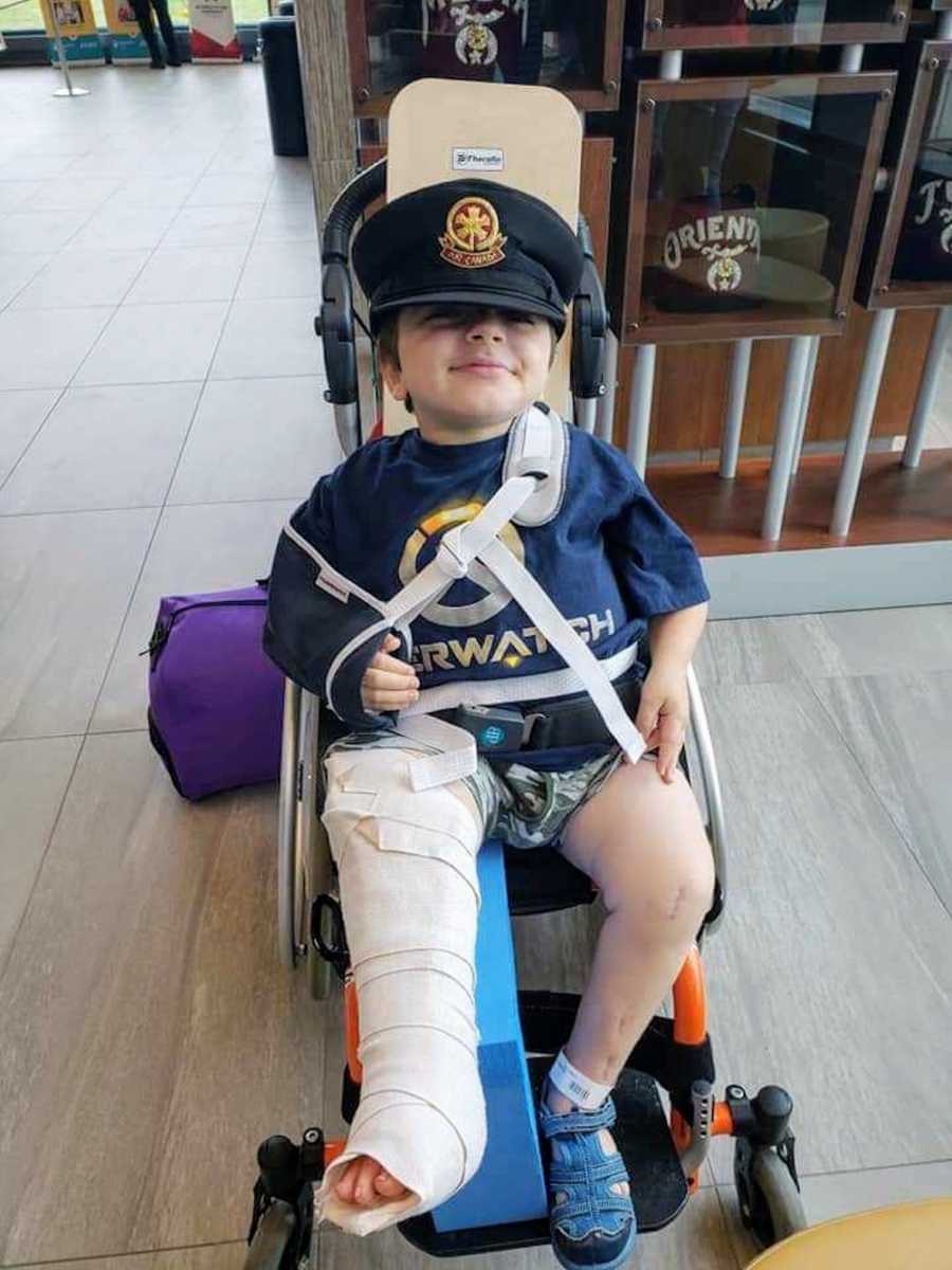 Little boy who will never be able to walk sits in wheelchair smiling with cast on her leg and sling on his arm