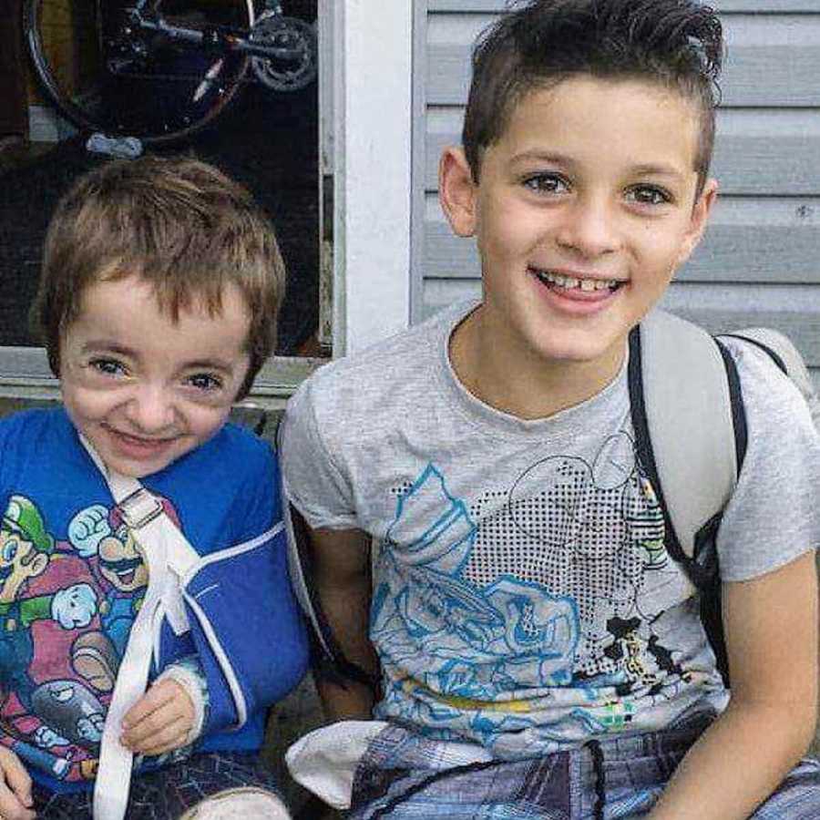 Young boy sits outside house beside younger brother in sling who has had over 14 surgeries and countless hospitilizations