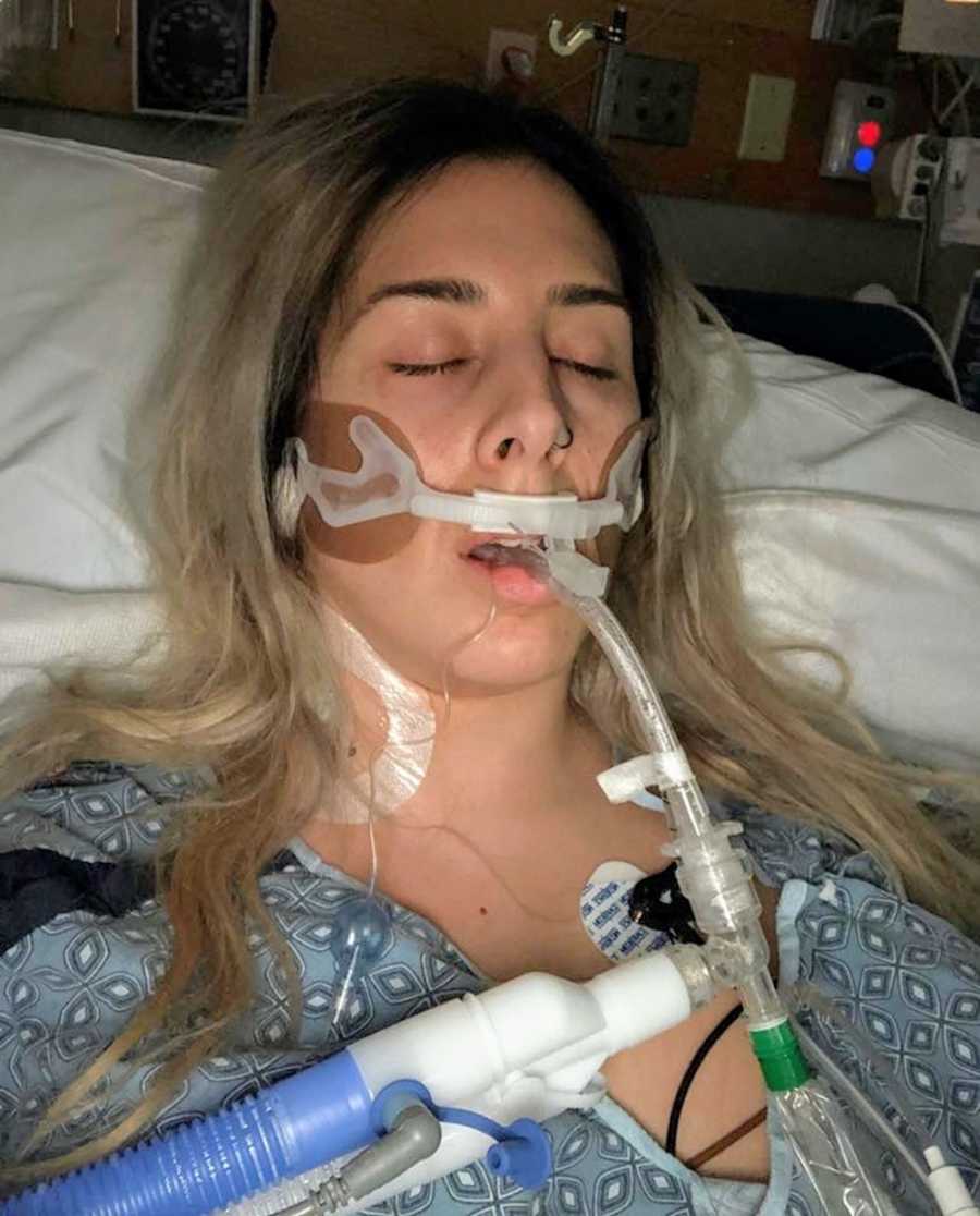 Woman with toxic shock syndrome laying in hospital bed in ICU