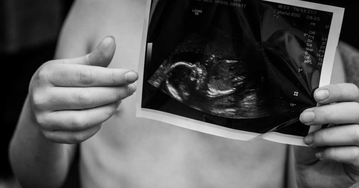 'It was two days after the ultrasound when my body ...