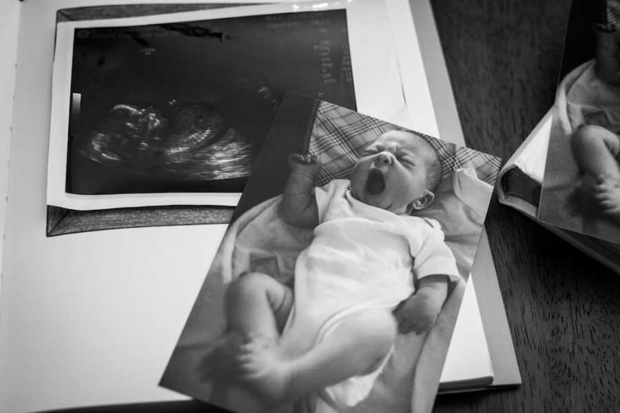 Yawning baby in photograph sits on table beside ultrasound of sibling who was miscarried