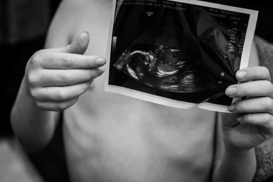 Shirtless young kid holds ultrasound picture of sibling in front of their chest