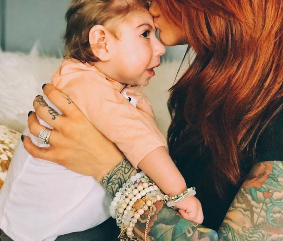 Mother holds and kisses forehead of baby with Lissencephaly