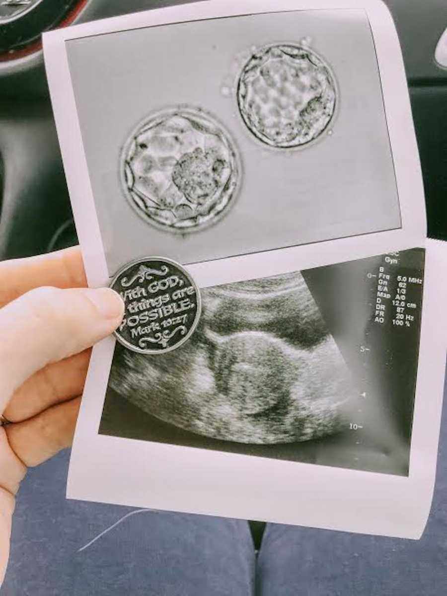 Woman holding pictures of implanted embryos and ultrasound of baby