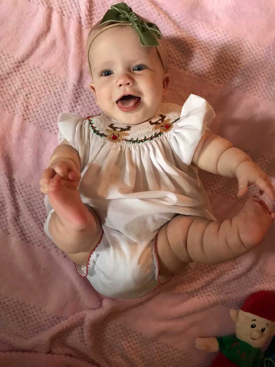 Baby girl with mild form of dwarfism lays on back smiling while holding her feet