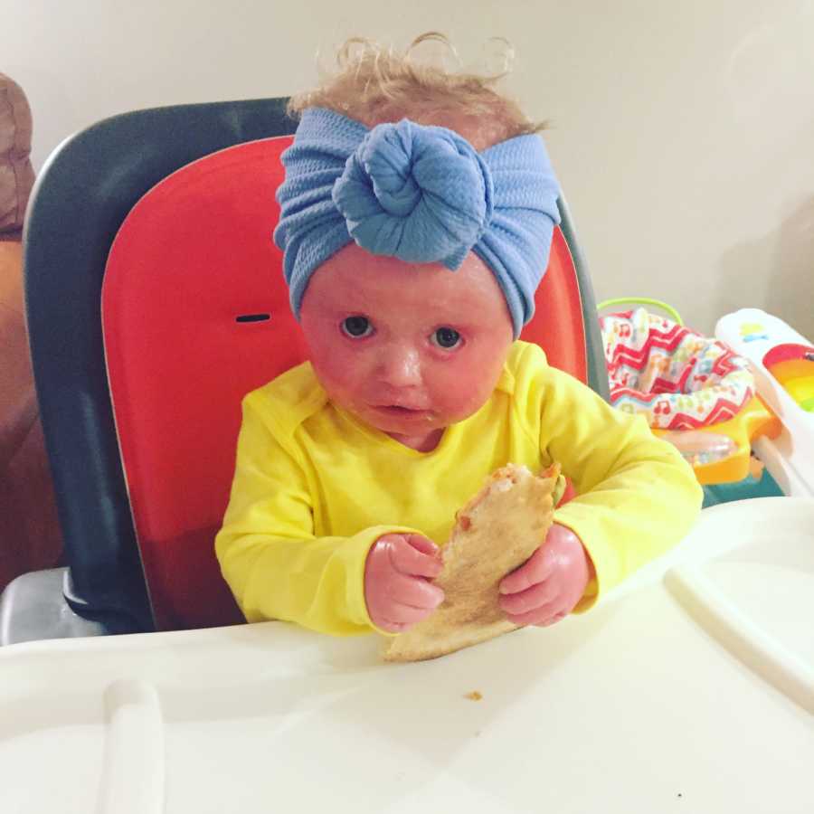Baby girl with Harlequin Ichthyosis sitting at high chair eating food