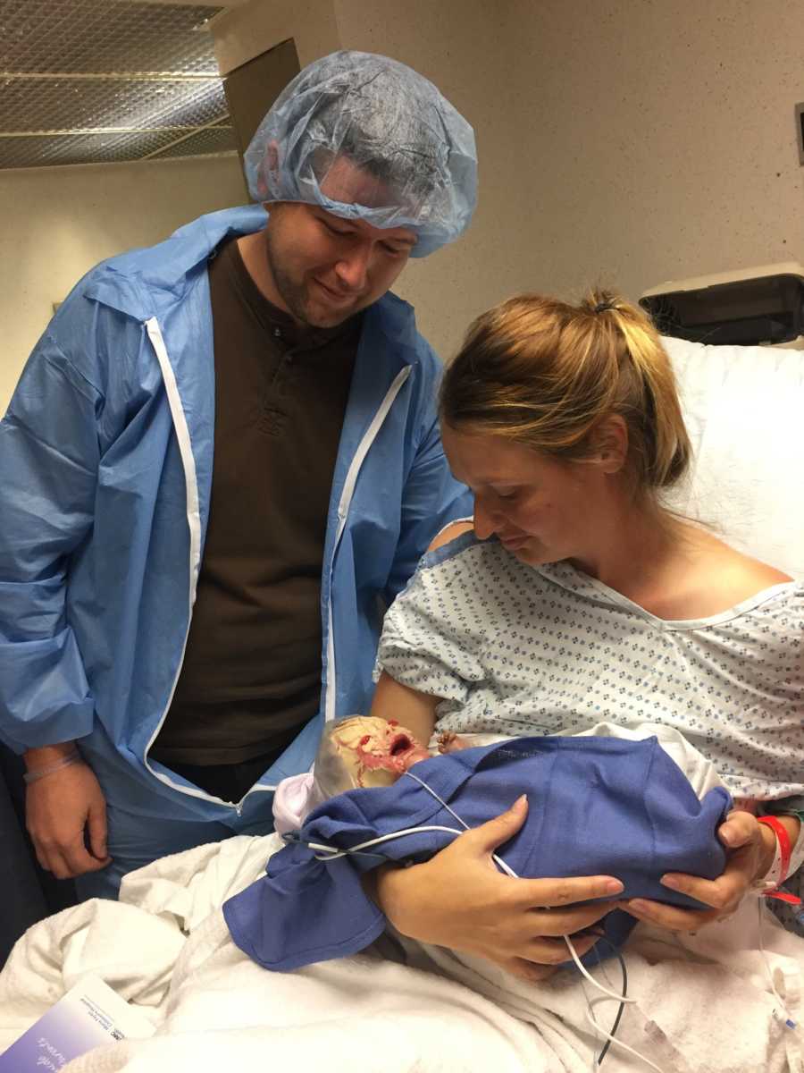 Mother sits up in hospital bed holding newborn with Harlequin Ichthyosis while husband stands beside her with hairnet on