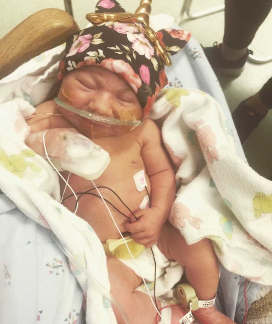 Newborn with Lissencephaly lays in NICU wearing diaper and unicorn hat