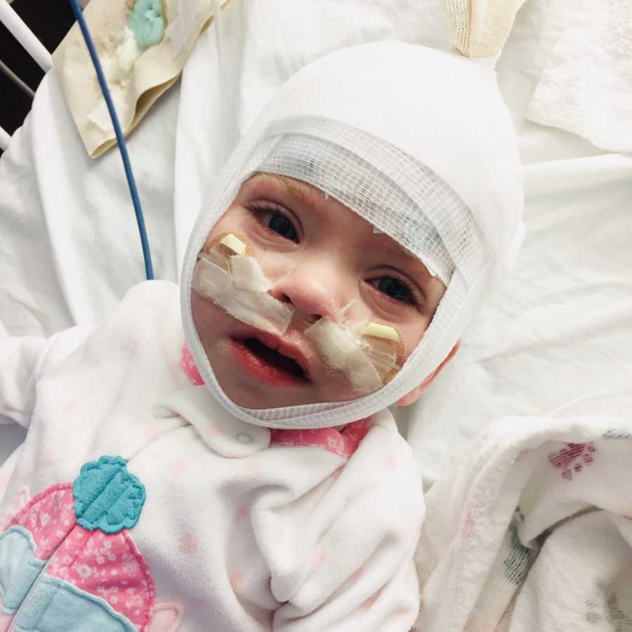 Baby lays in NICU with bandage wrapped around her head