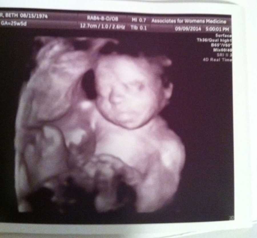 3D ultrasound of woman's baby 