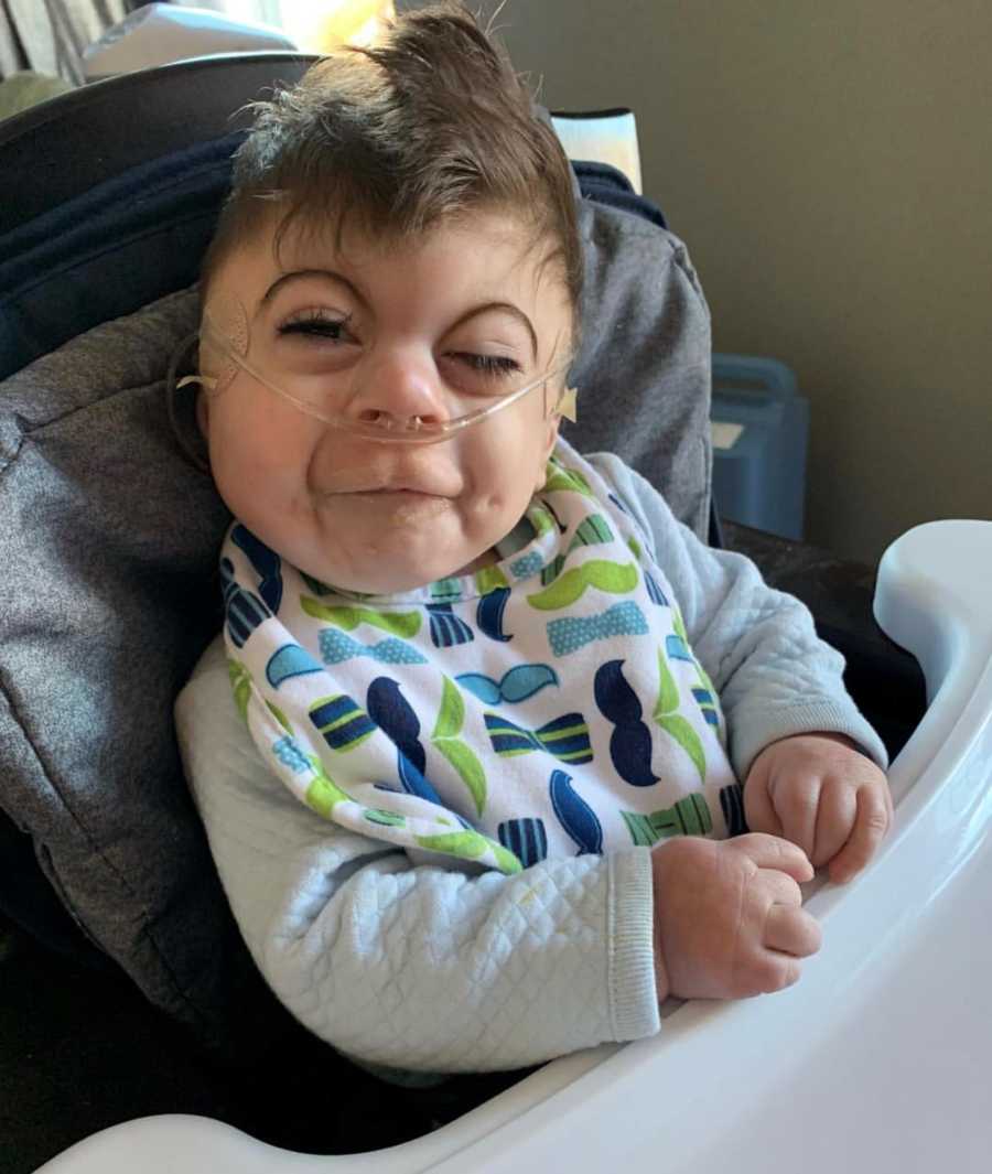Baby with Cornelia de Lange syndrome smiles as he sits in high chair