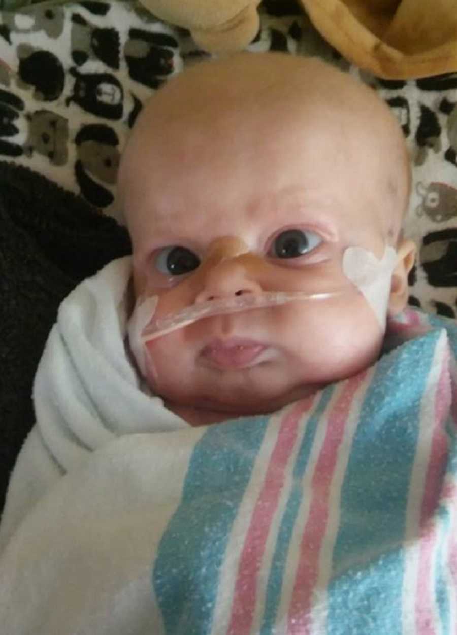 Newborn with brain cancer lays swaddled in blanket with tube taped to his face
