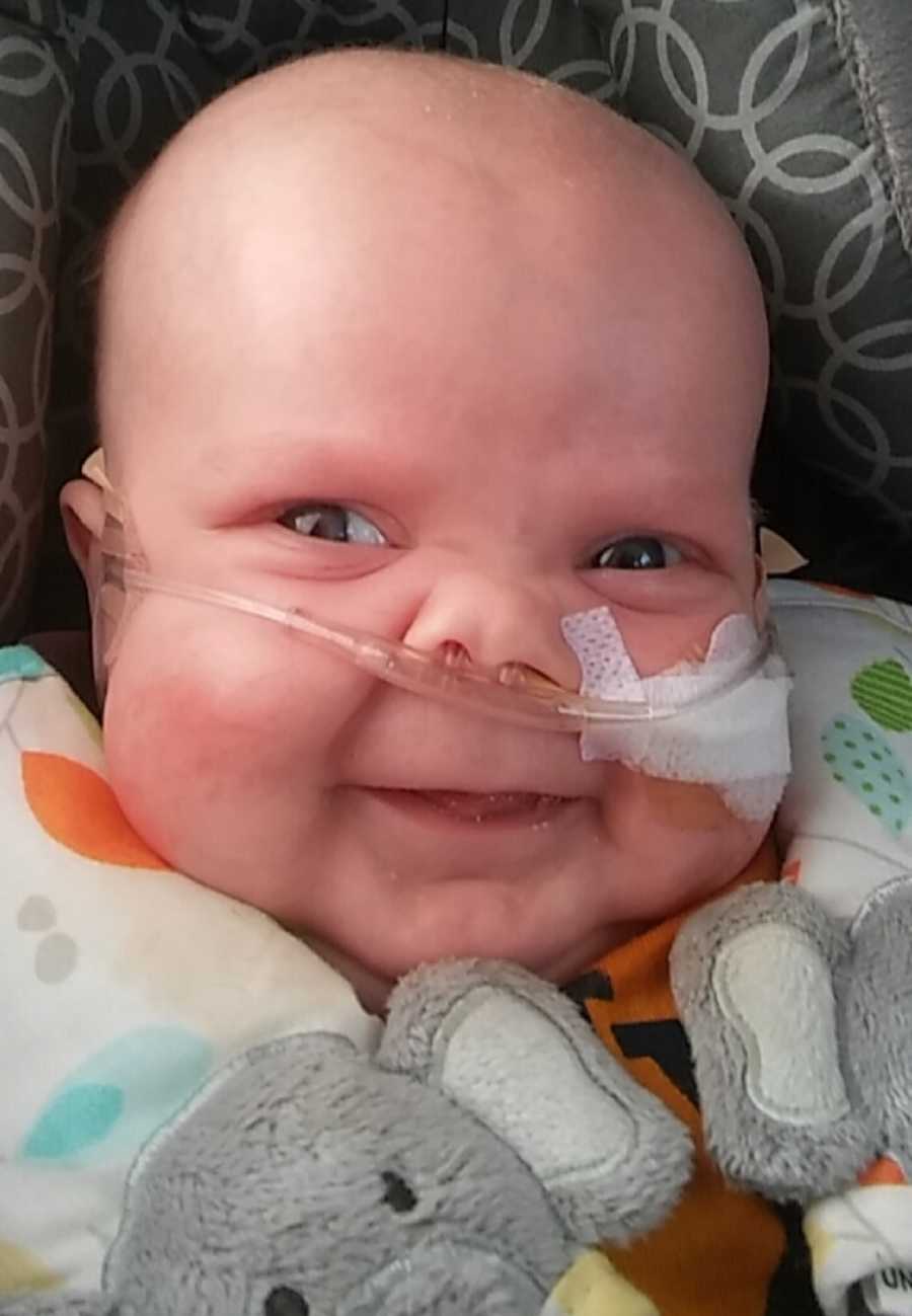 Baby on oxygen smiles as he sits in carseat 