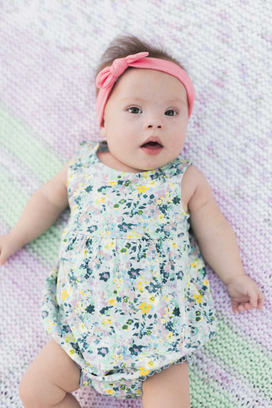 Baby with down syndrome and heart defect lays on back wearing pink head band and floral onesie