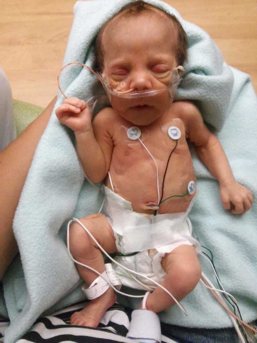 Newborn lays on mothers lap in NICU