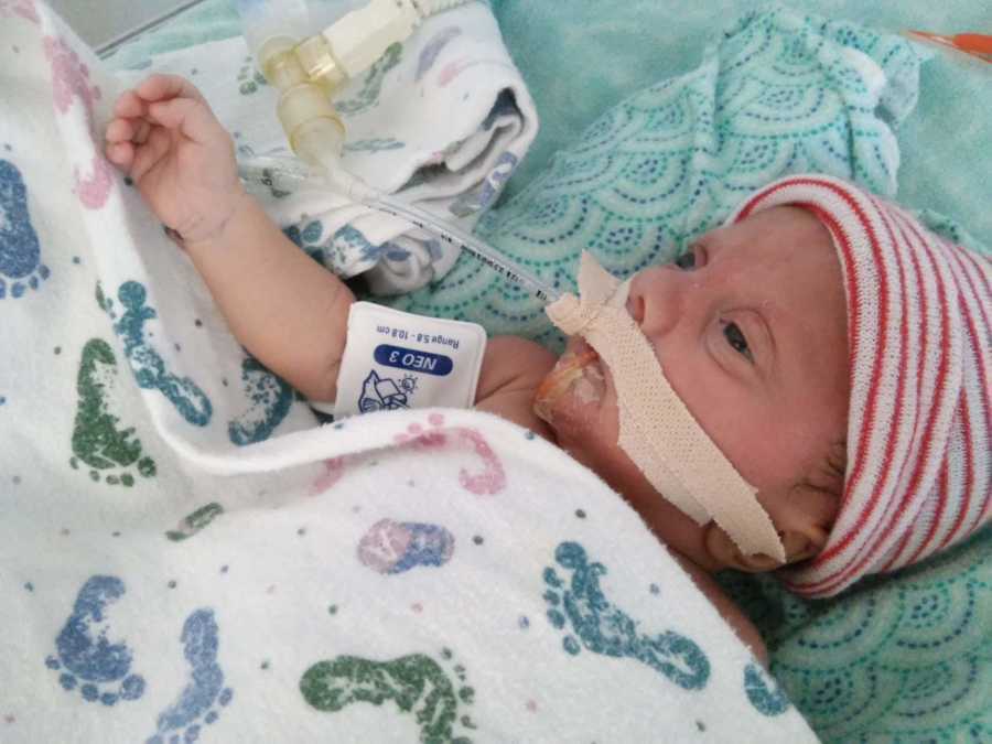 Newborn who was born through natural birth, lays in NICU