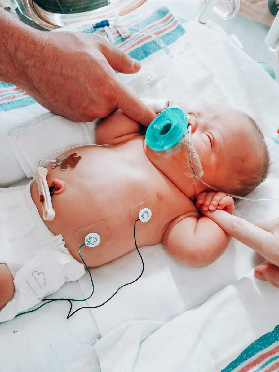 Newborn with dwarfism lays in NICU while holding onto mother and father's fingers
