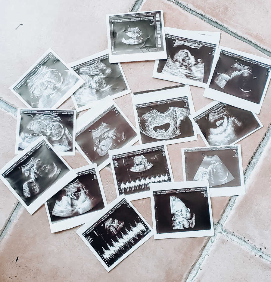 Several ultrasound photos scattered on ground