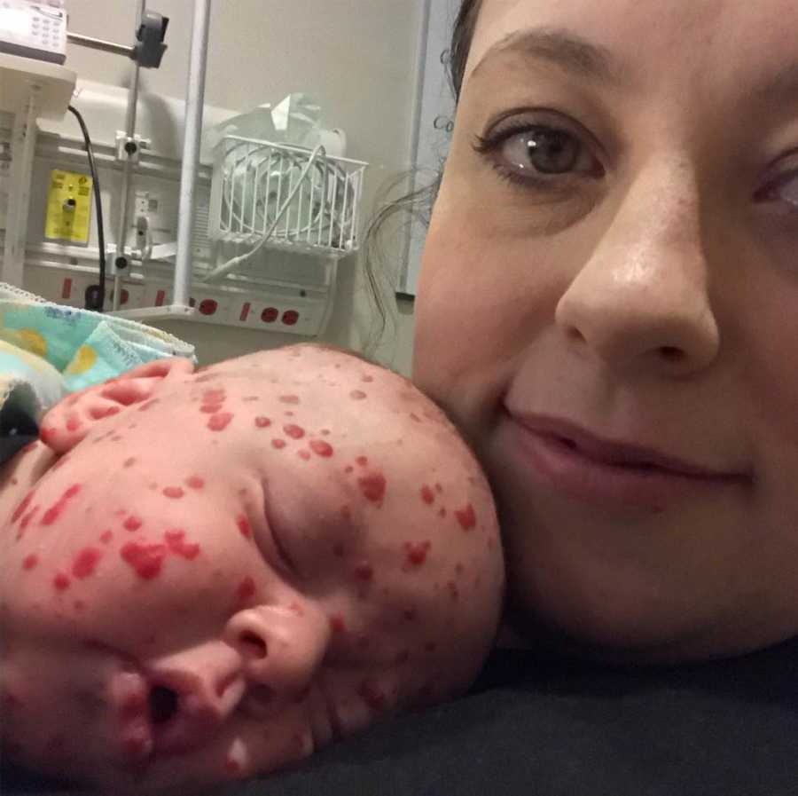 Mother smiles in selfie while her newborn with rare skin condition lays on her chest