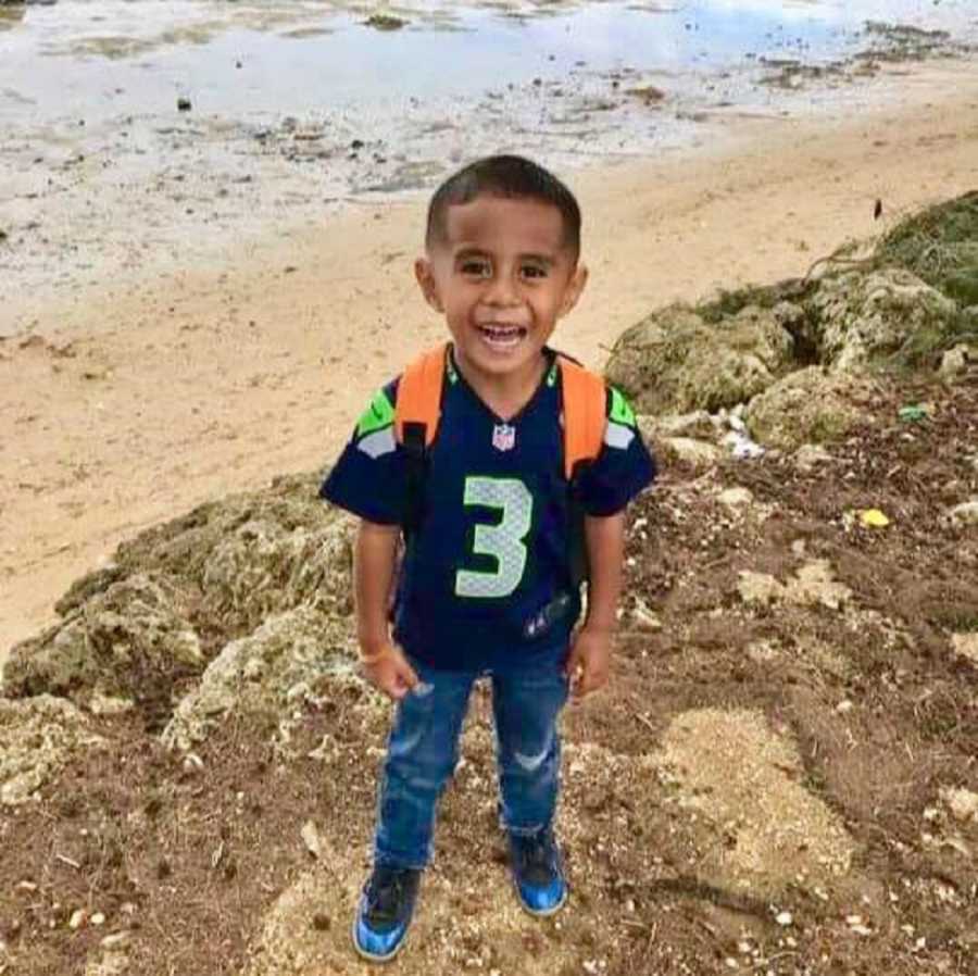 Little boy standing on rocks who has swollen spleen