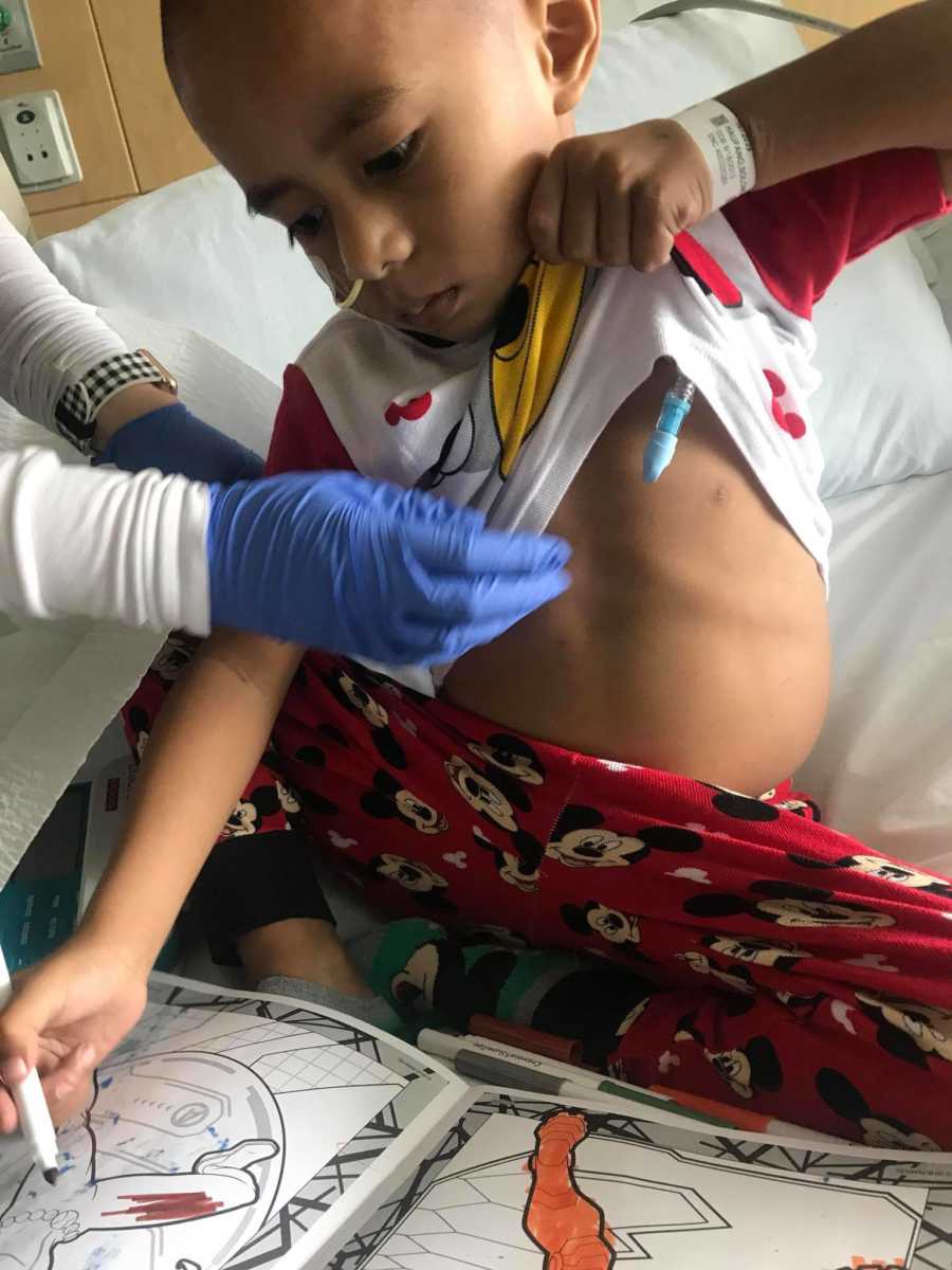 Little boy with cancer sits in hospital bed coloring in coloring book holding up his shirt while nurse tends to him