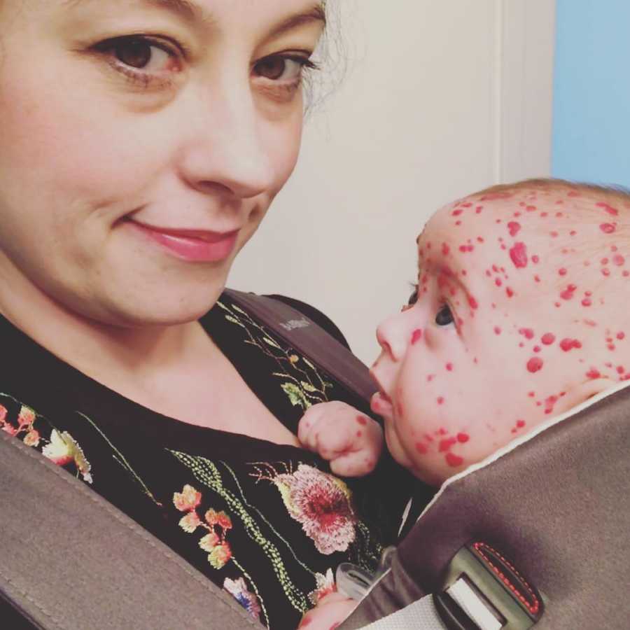 Mother smiles in selfie as she her newborn with rare skin condition is swaddled to her chest