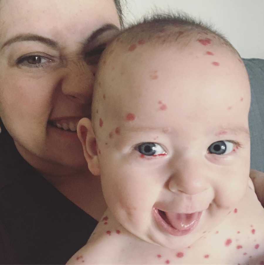 Mother smiles in selfie while son who has rare skin disease sits on her lap with his tongue out