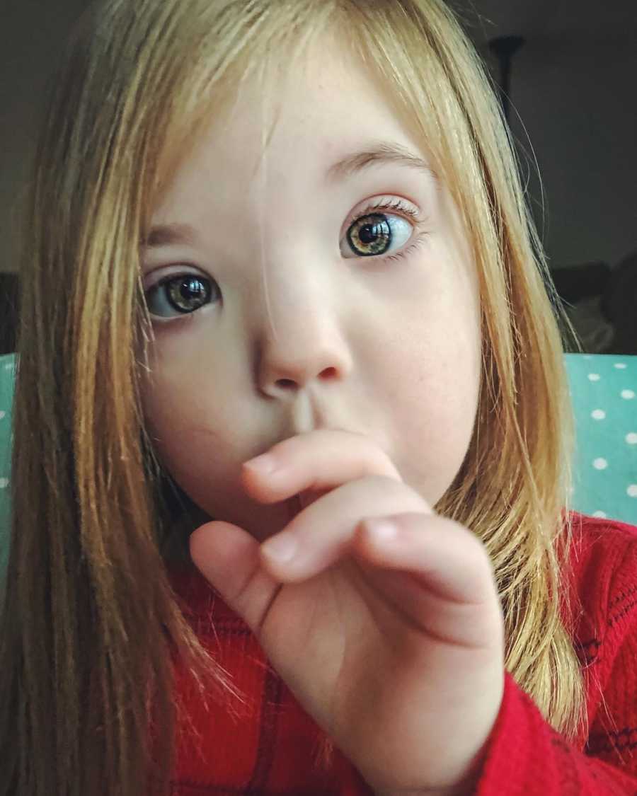 Close up of little girl with down syndrome's face who holds hand up to her mouth