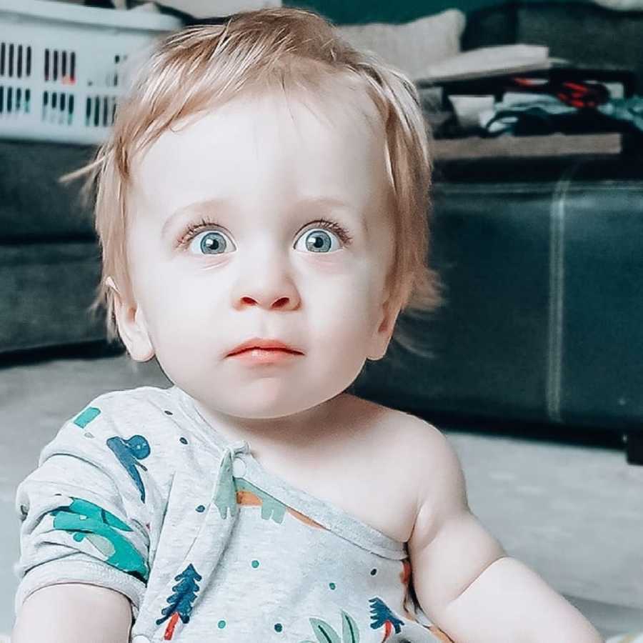 Baby boy with dwarfism sits on floor of home with wide eyes