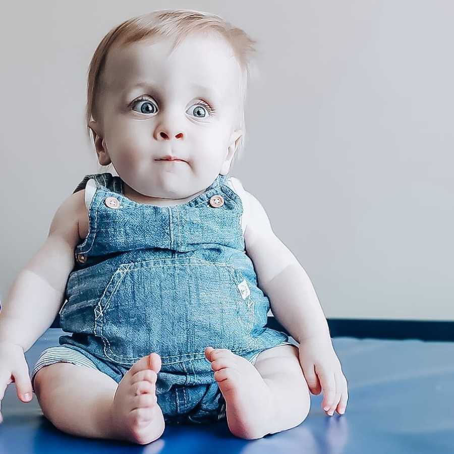 Baby with dwarfism sits wide eyed wearing denim overalls