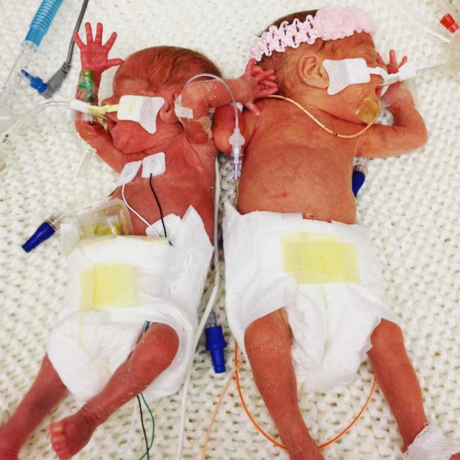 Preemie twins lay in NICU hooked up to monitors