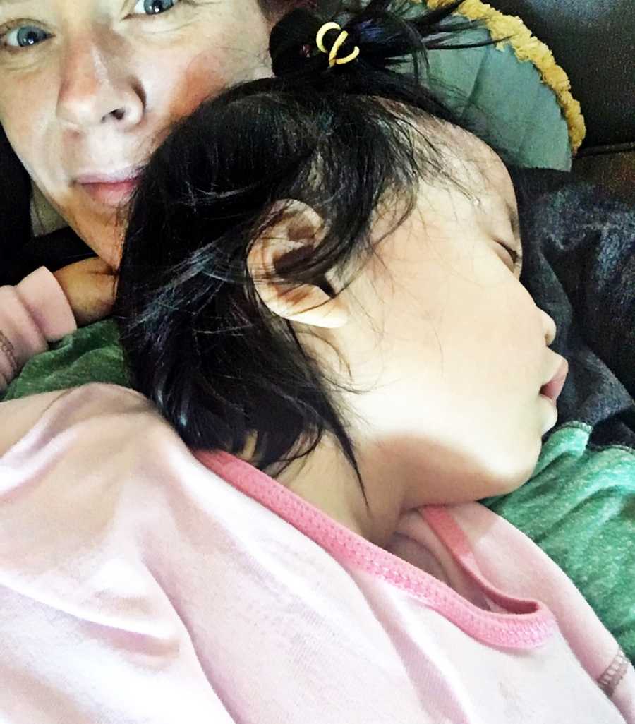 Baby who is deaf and blind lays asleep on mother's chest