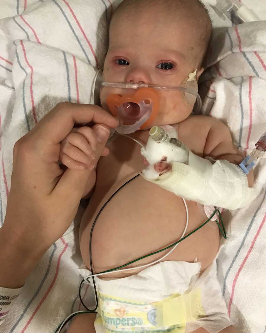 Newborn with down syndrome lays in NICU holding mothers hand