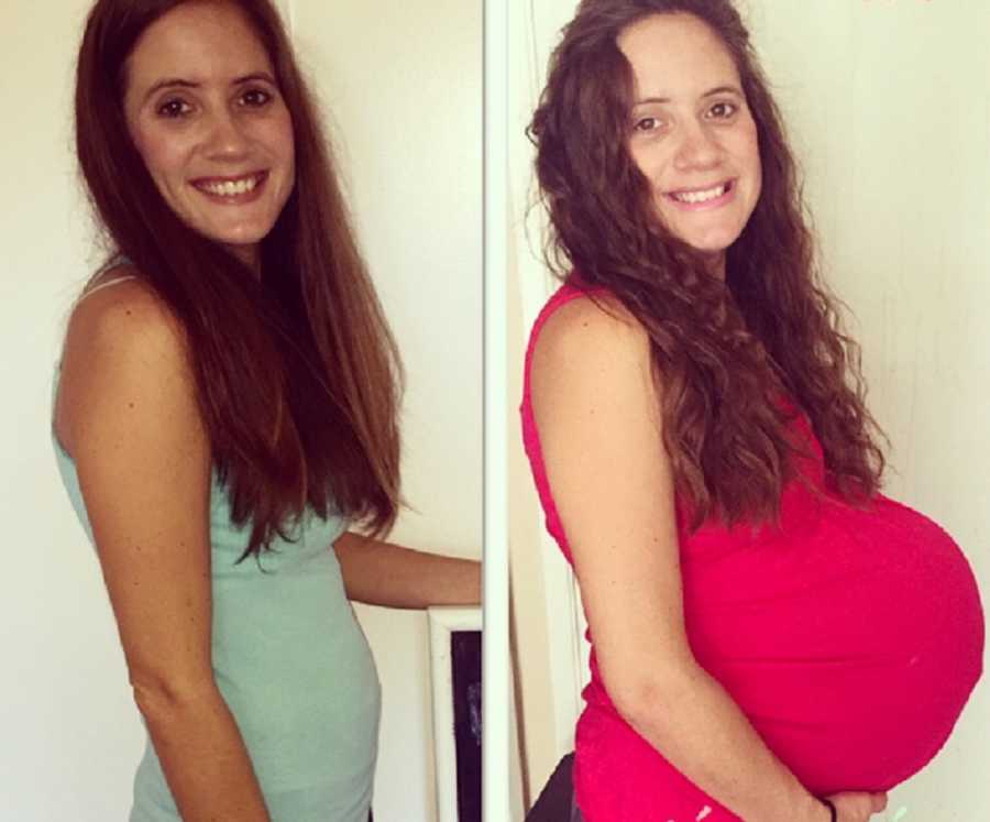 Side by side of woman before and after being pregnant with triplets