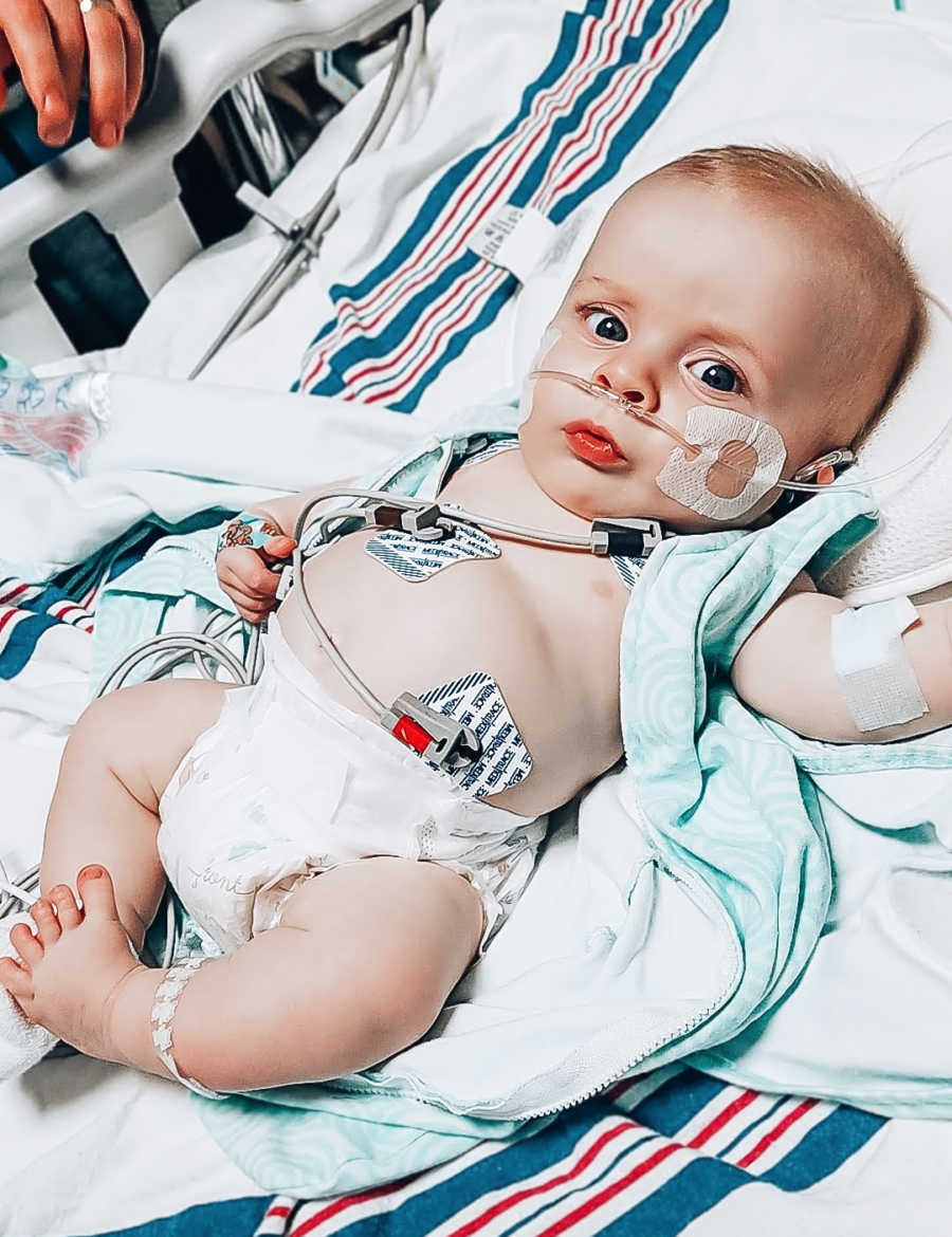 Newborn with dwarfism lays in hospital bed hooked up to monitors