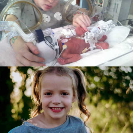 Side by side of baby laying in NICU and then her smiling as toddler