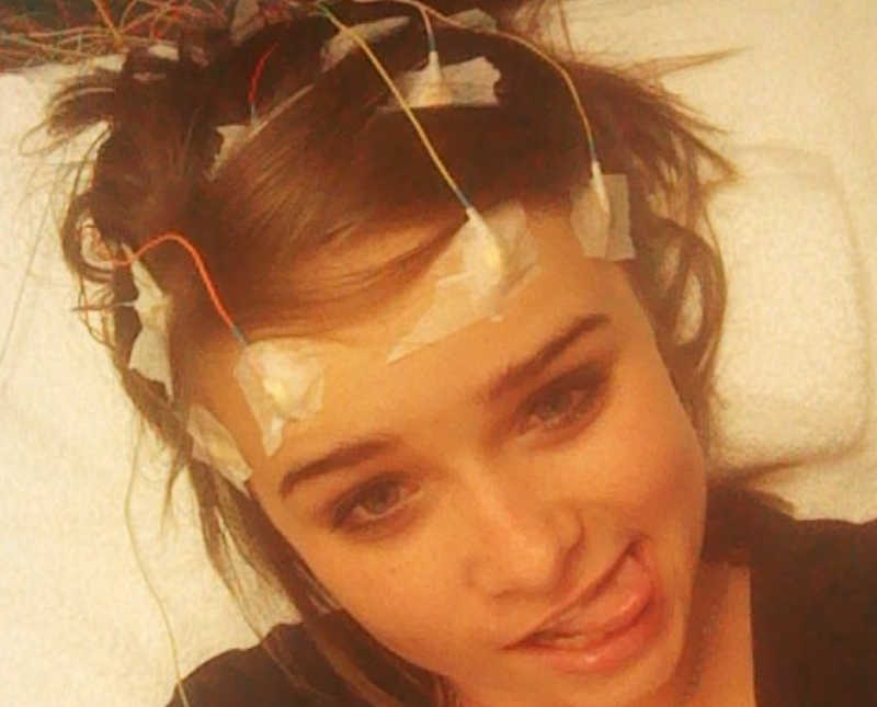 Teen who has seizures takes selfie with wires attached to her head