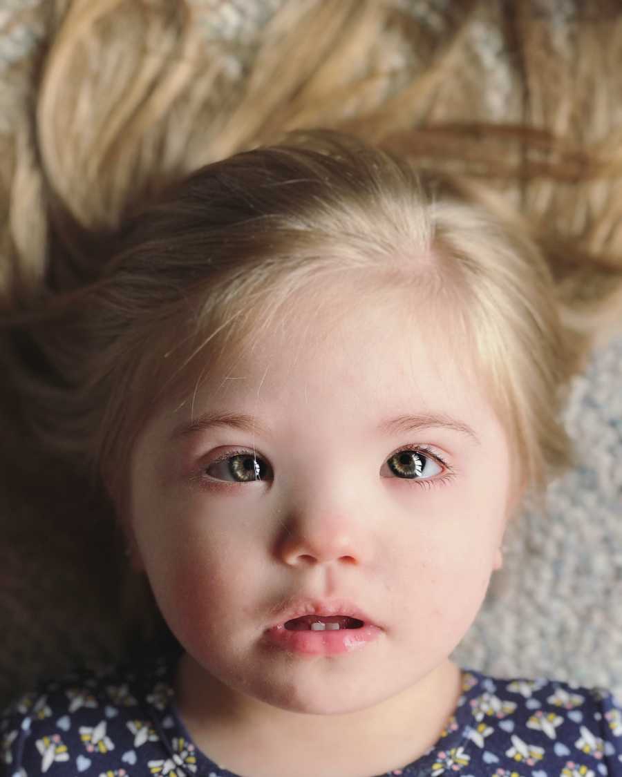 Close up of little girl with down syndrome's face who is lying on ground