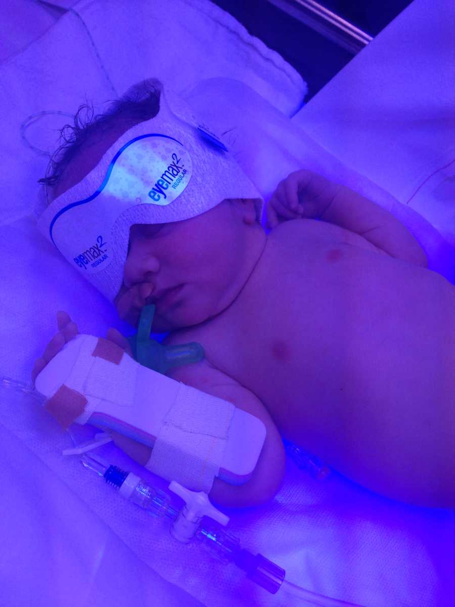 Newborn lays in NICU under blue light with brace on arm and mask over her eyes