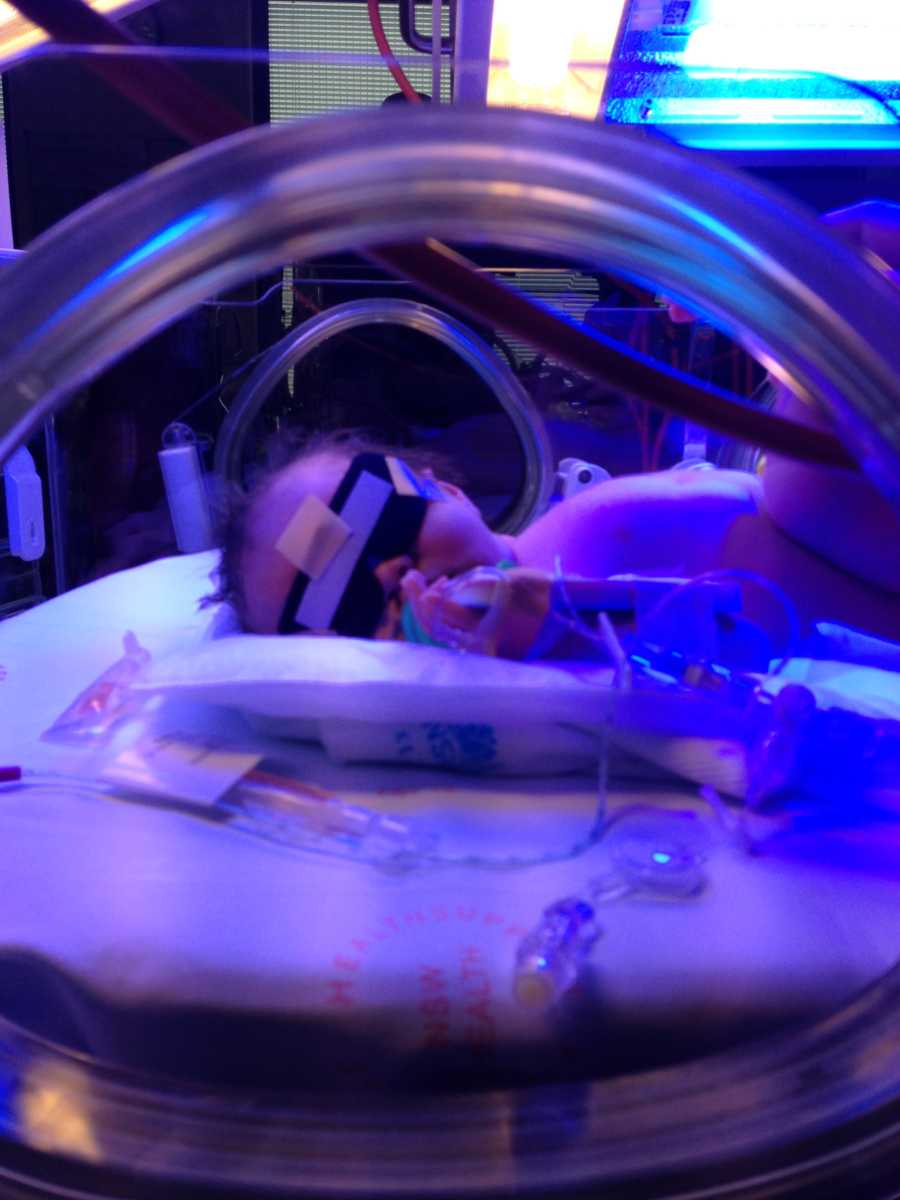 Newborn with eye mask on lays in NICU under blue light