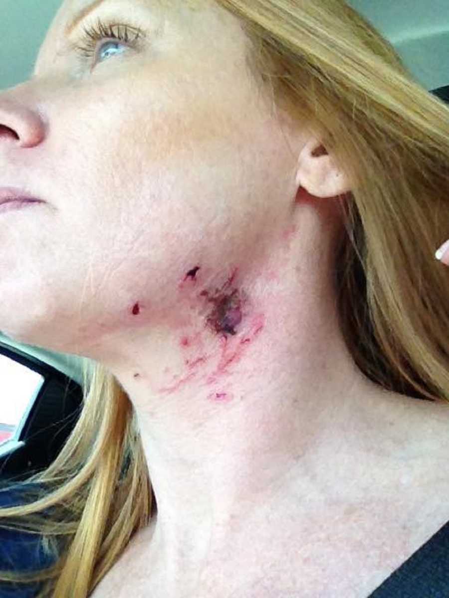 Woman sits in car with chin raised to show bloody gash on her throat